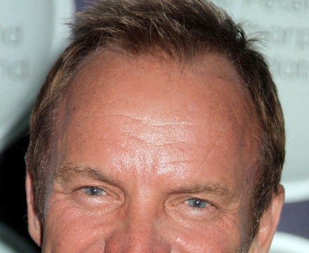 Sting